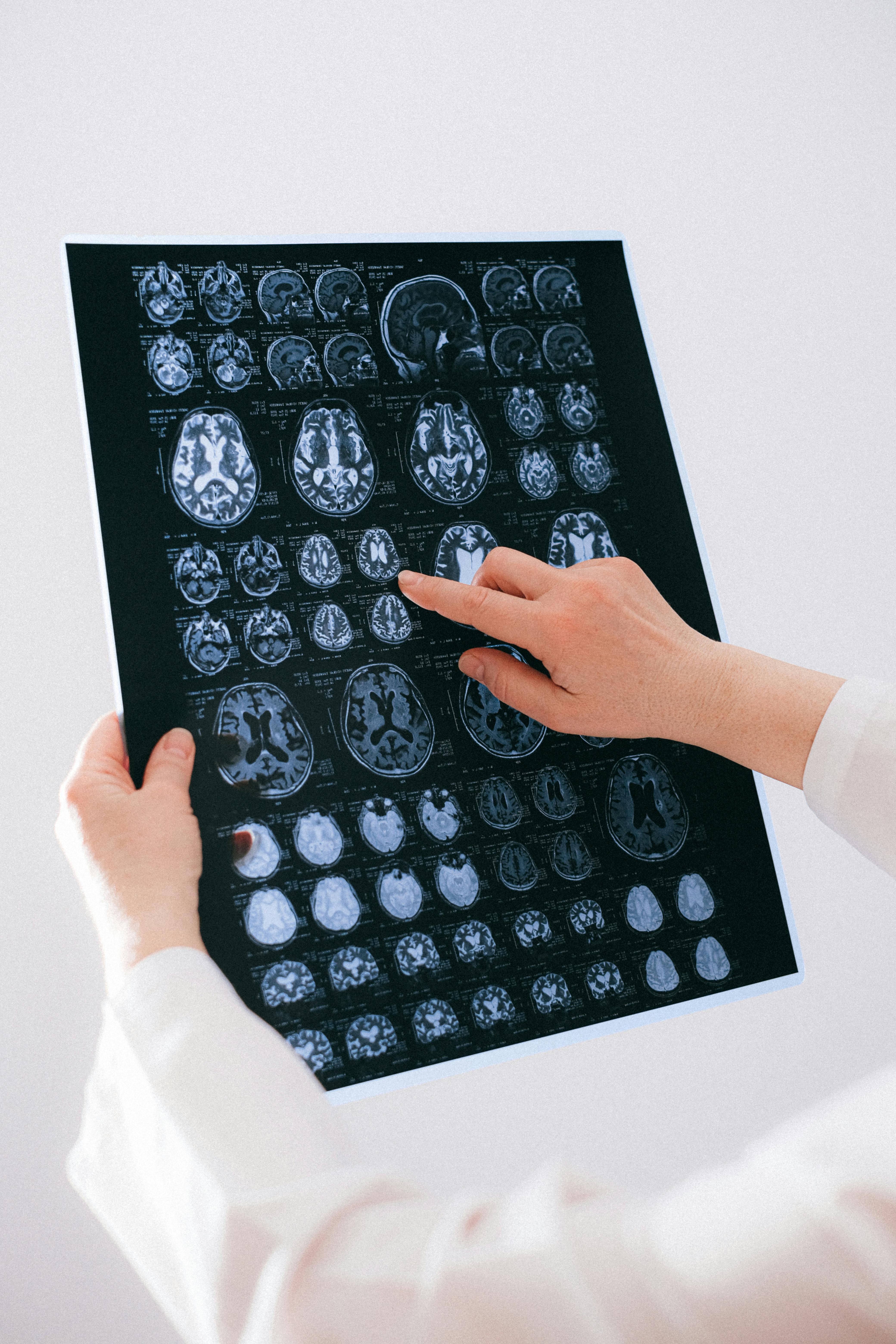 Neurology